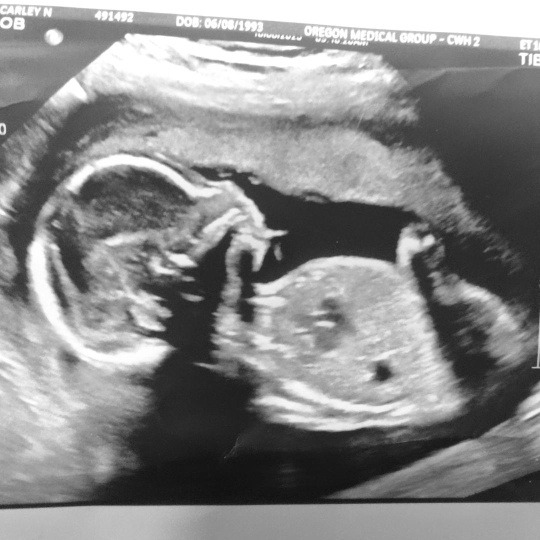 Photo shared by Carley for their Babylist baby registry.