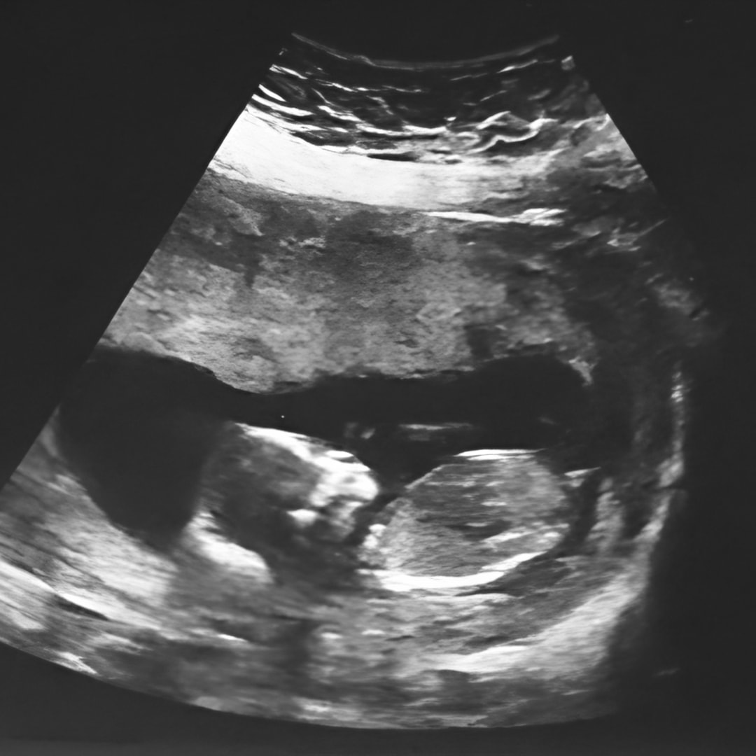 Photo shared by Catty & Andrew for their Babylist baby registry.