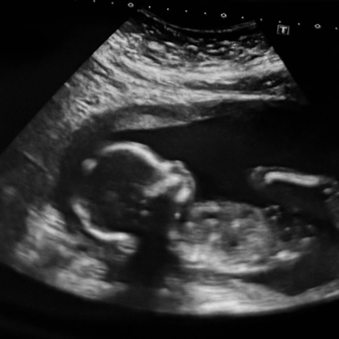 Photo shared by Mia for their Babylist baby registry.