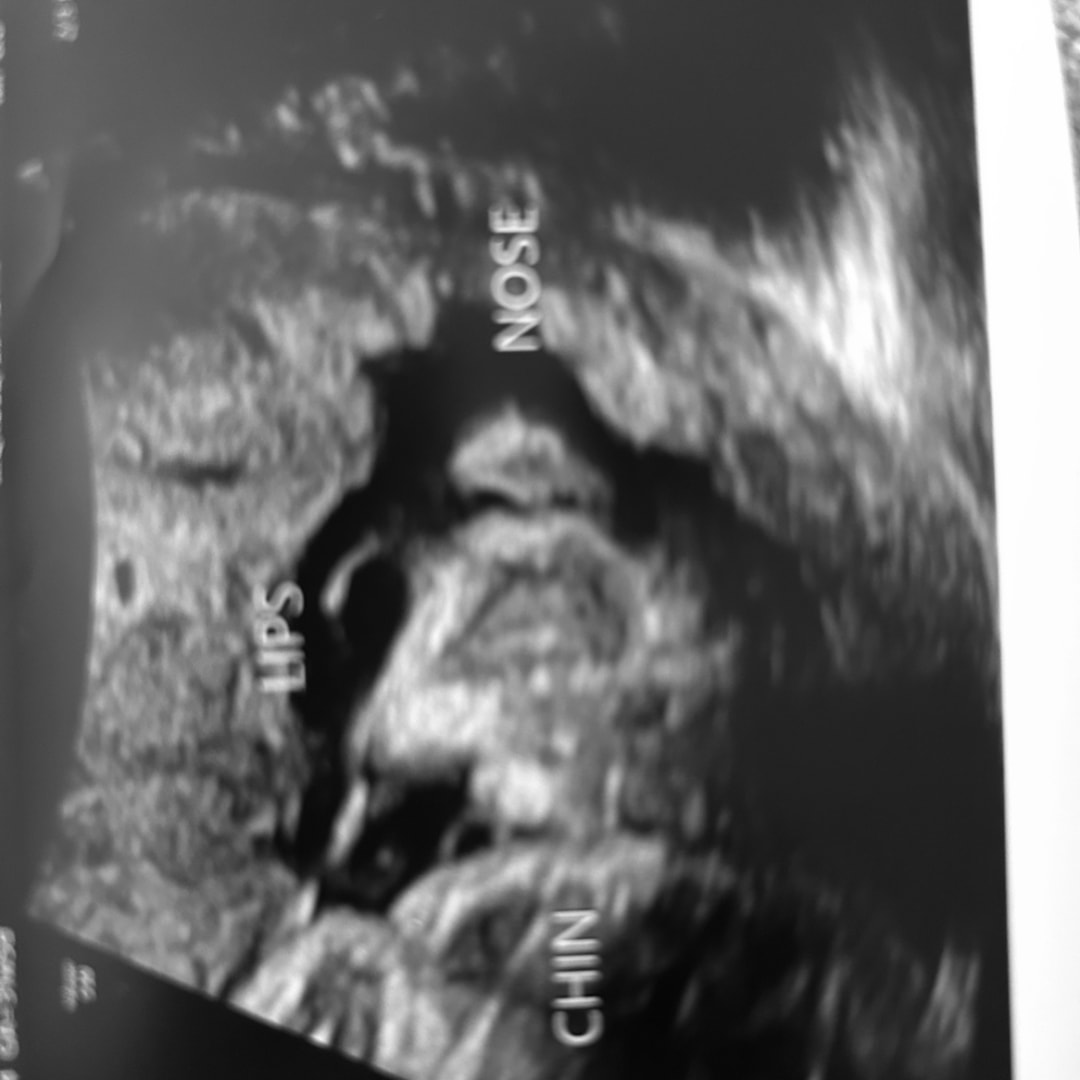 Photo shared by Aaliyah for their Babylist baby registry.
