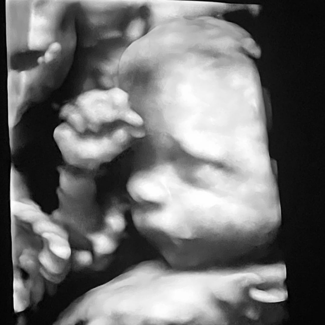 Photo shared by Johi for their Babylist baby registry.