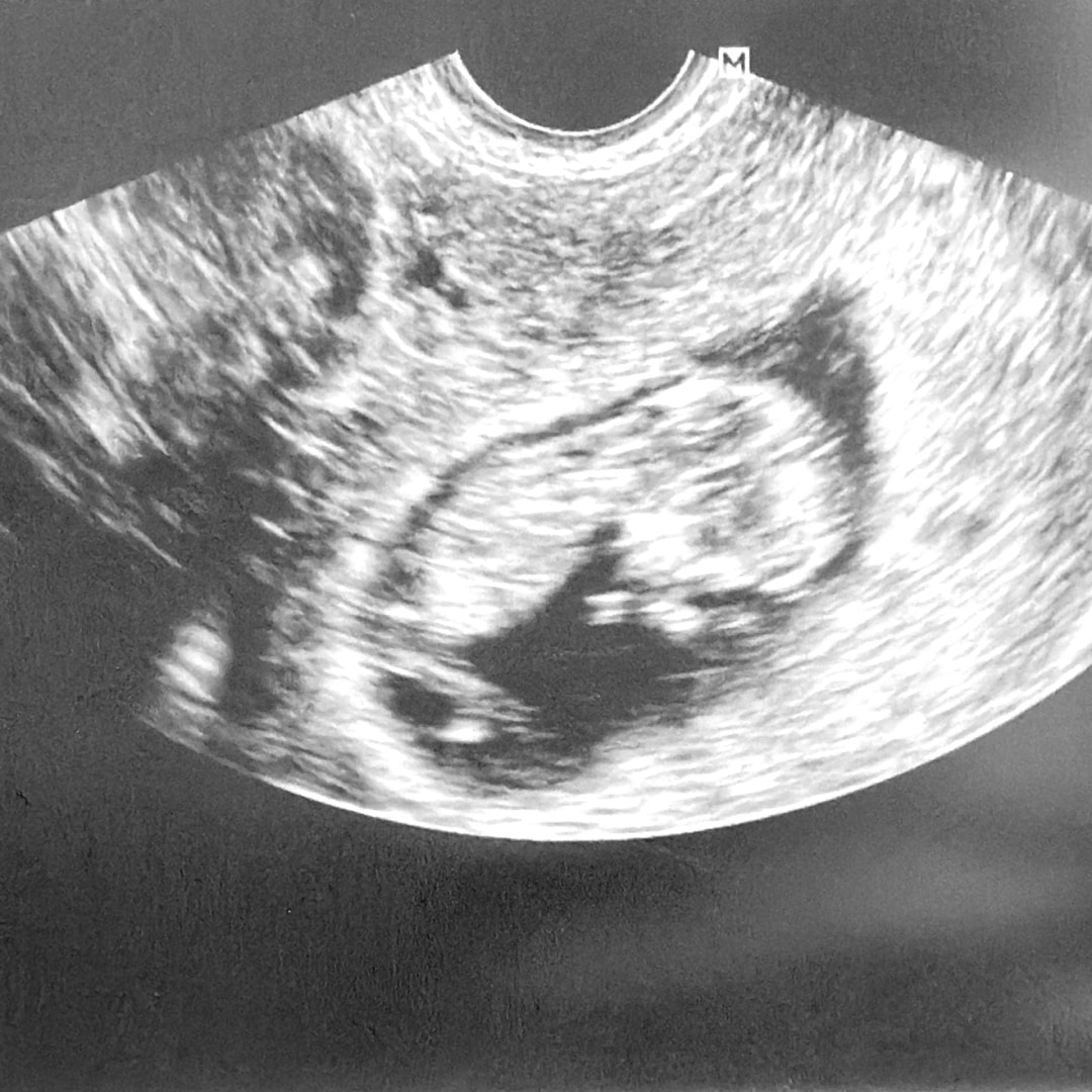 Photo shared by Frencesca for their Babylist baby registry.