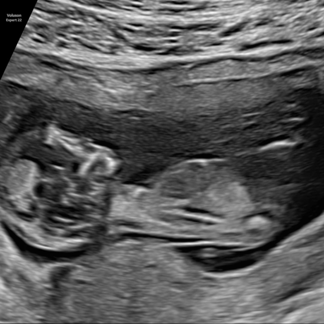 Photo shared by Jenny for their Babylist baby registry.