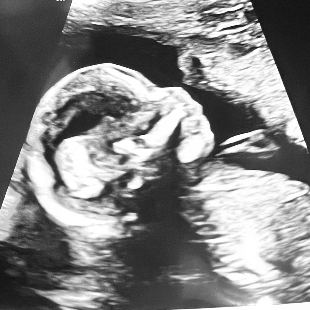 Photo shared by Gavin for their Babylist baby registry.