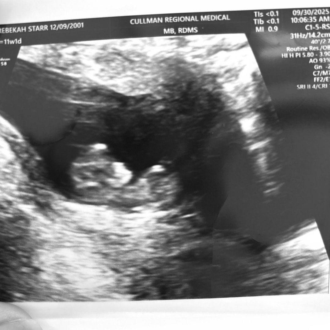 Photo shared by Rebekah for their Babylist baby registry.