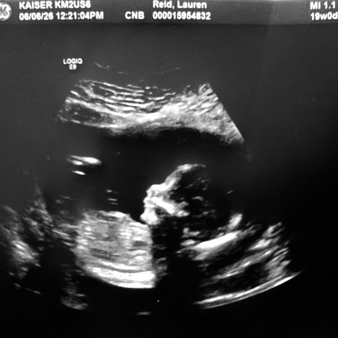 Photo shared by Lauren for their Babylist baby registry.