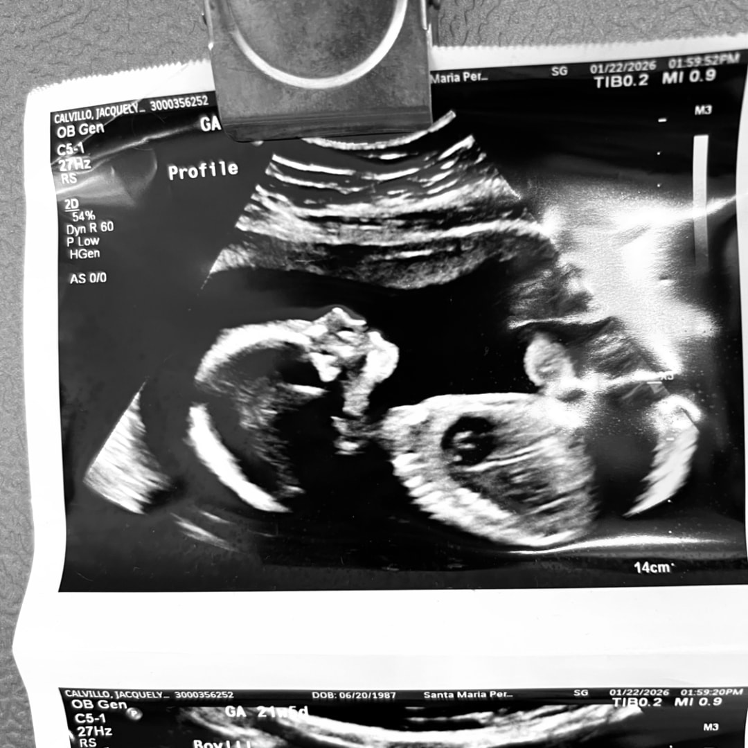 Photo shared by Jacquelyn for their Babylist baby registry.