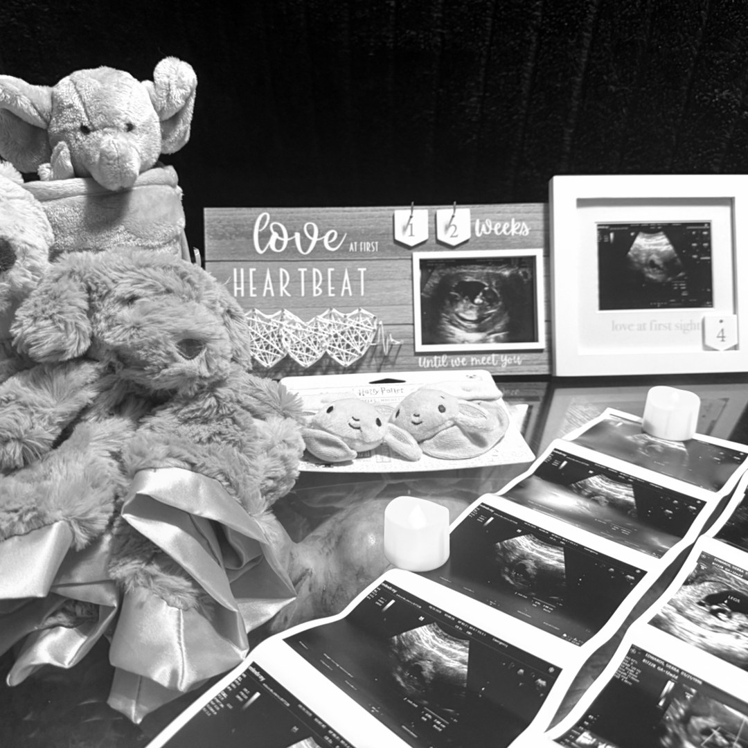 Photo shared by Sierra for their Babylist baby registry.