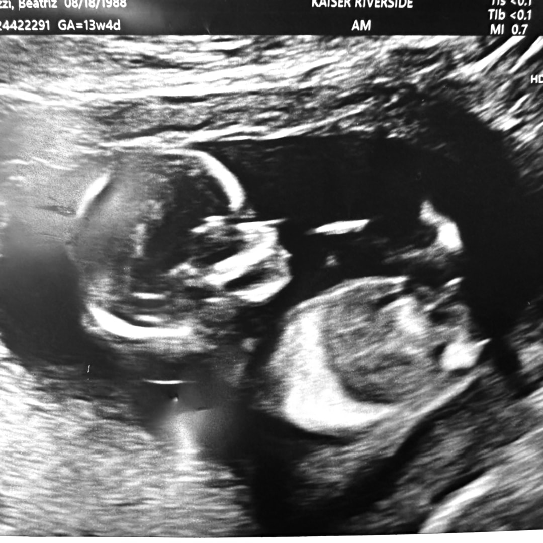 Photo shared by Beatriz for their Babylist baby registry.