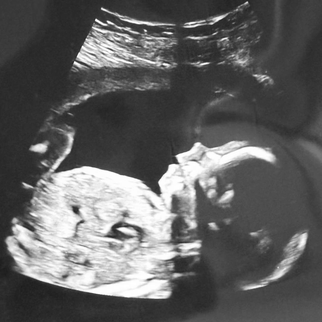 Photo shared by Kat for their Babylist baby registry.