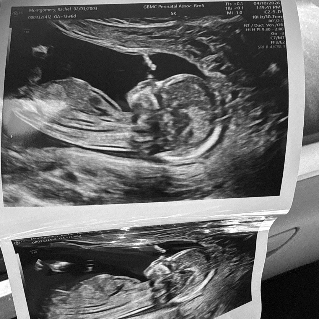 Photo shared by Rachel for their Babylist baby registry.
