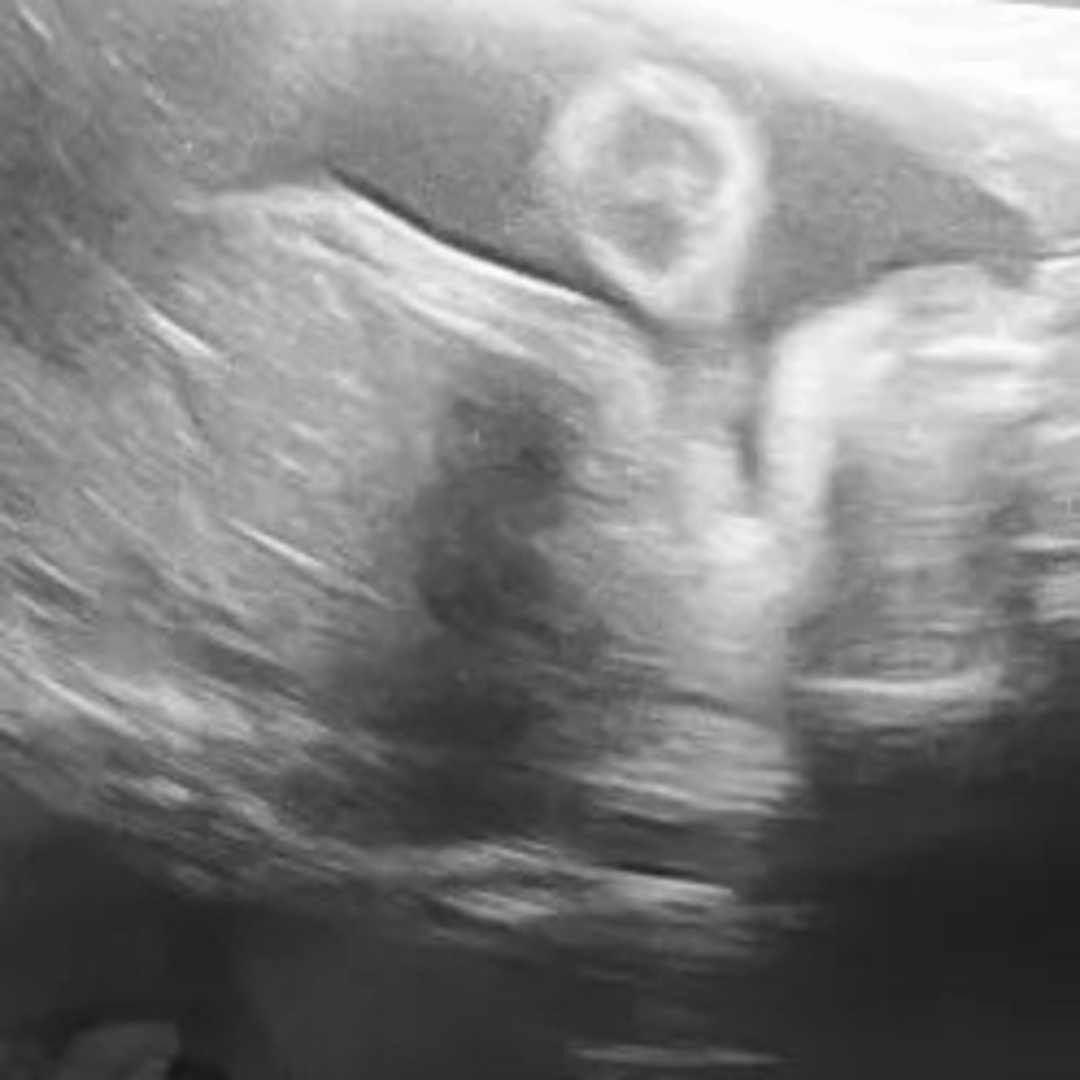 Photo shared by Bianca for their Babylist baby registry.