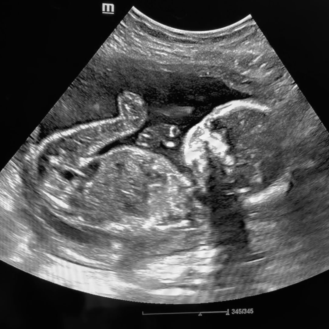 Photo shared by Abbi for their Babylist baby registry.