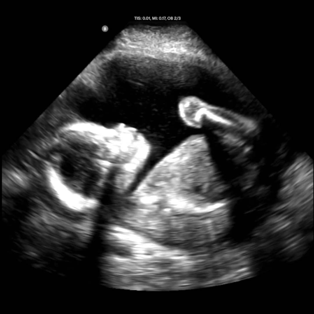 Photo shared by Amanda for their Babylist baby registry.