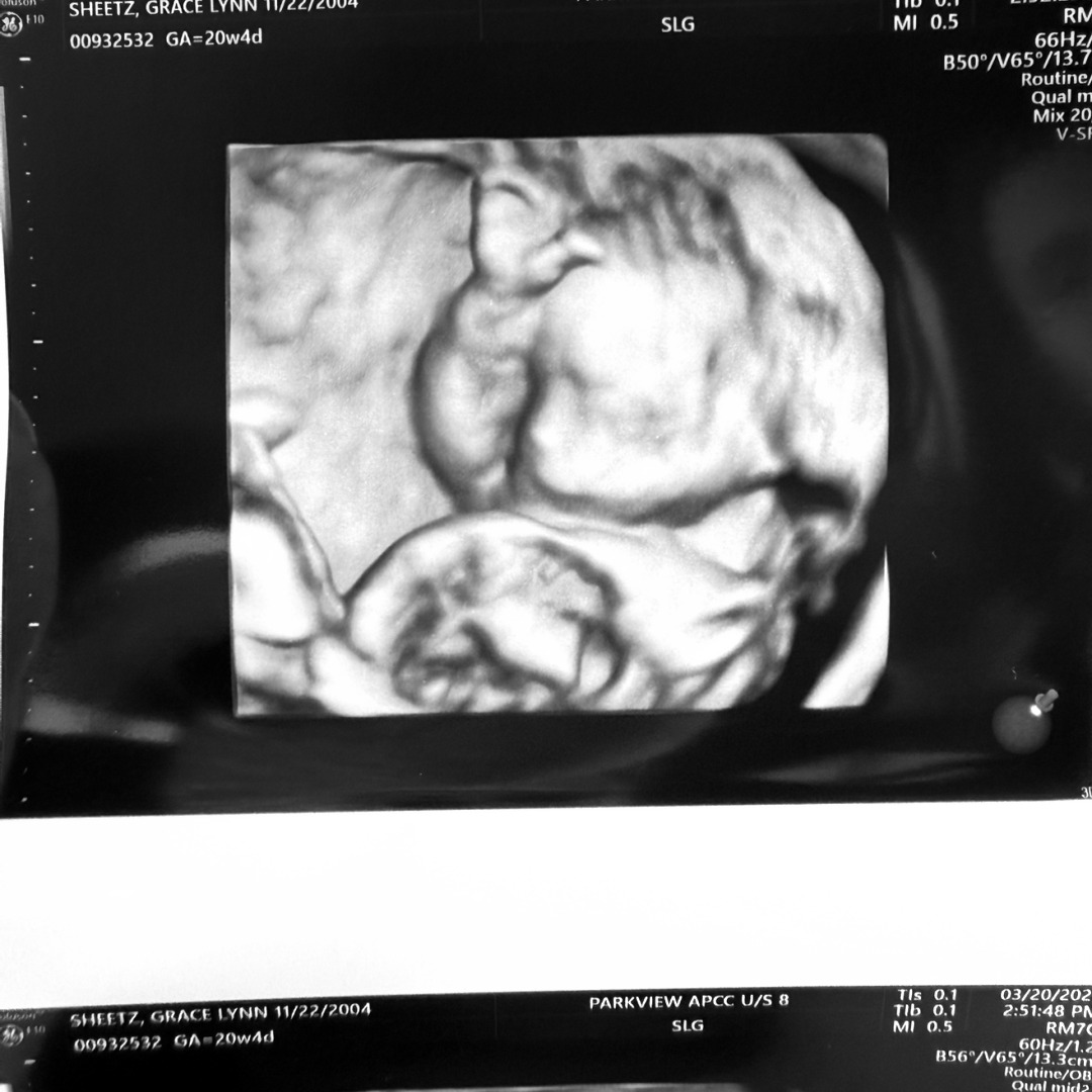 Photo shared by Grace for their Babylist baby registry.