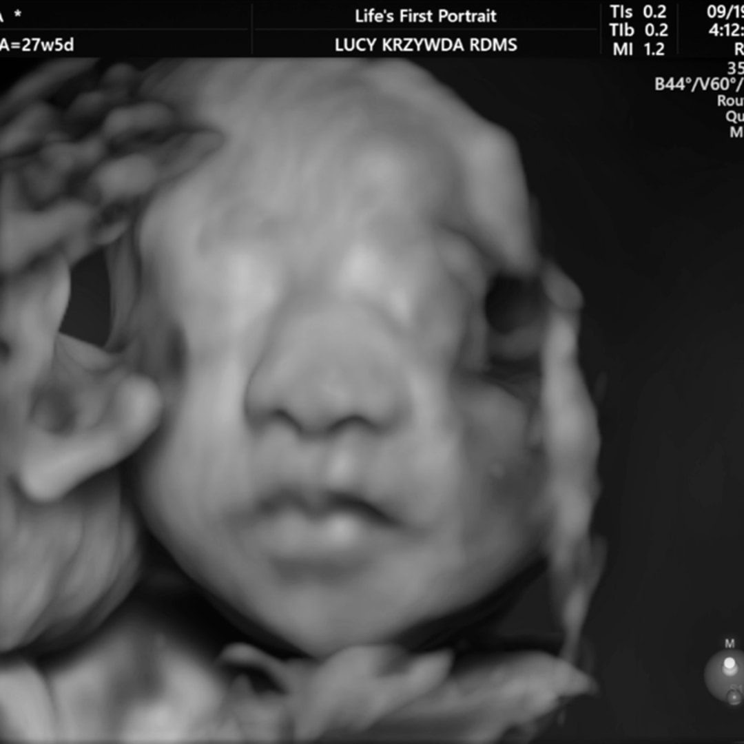 Photo shared by Natalia for their Babylist baby registry.