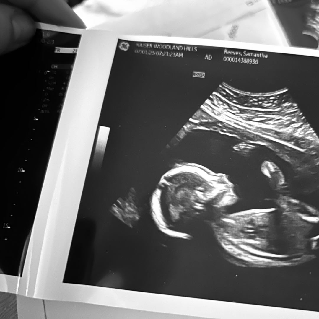 Photo shared by Samantha for their Babylist baby registry.