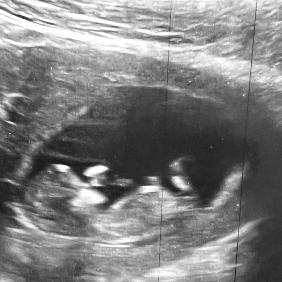 Photo shared by Jennifer for their Babylist baby registry.