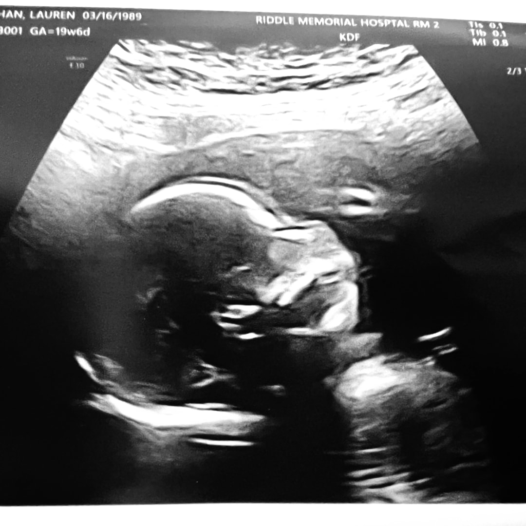 Photo shared by Lauren for their Babylist baby registry.