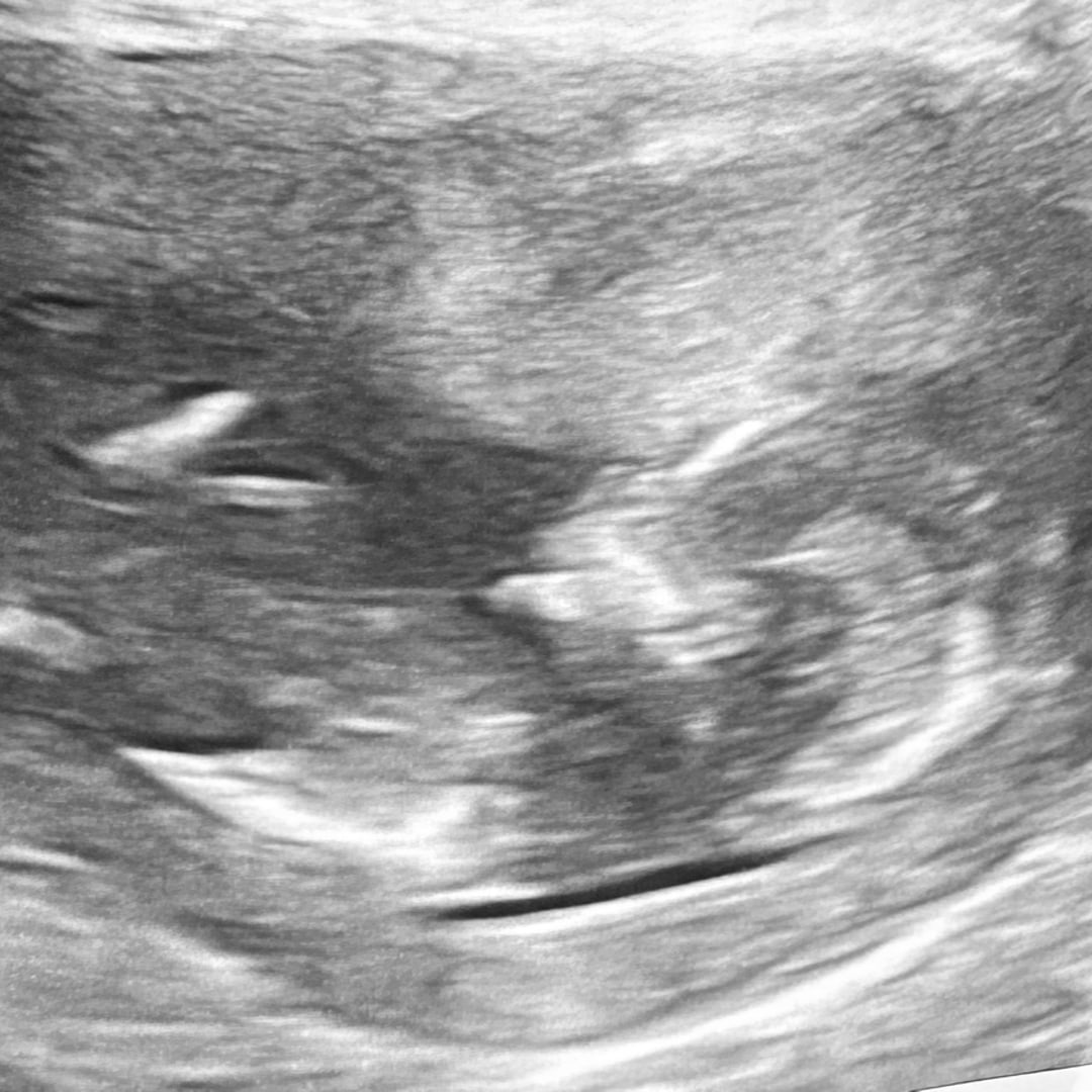 Photo shared by Allyson for their Babylist baby registry.