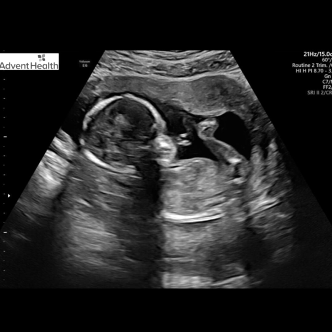 Photo shared by Kayla for their Babylist baby registry.