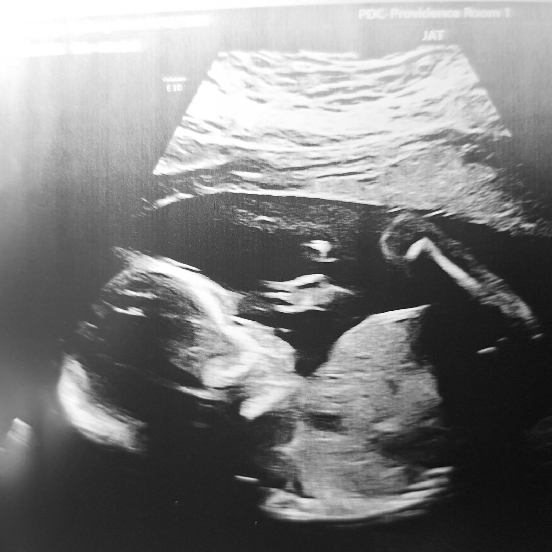 Photo shared by Cydney for their Babylist baby registry.