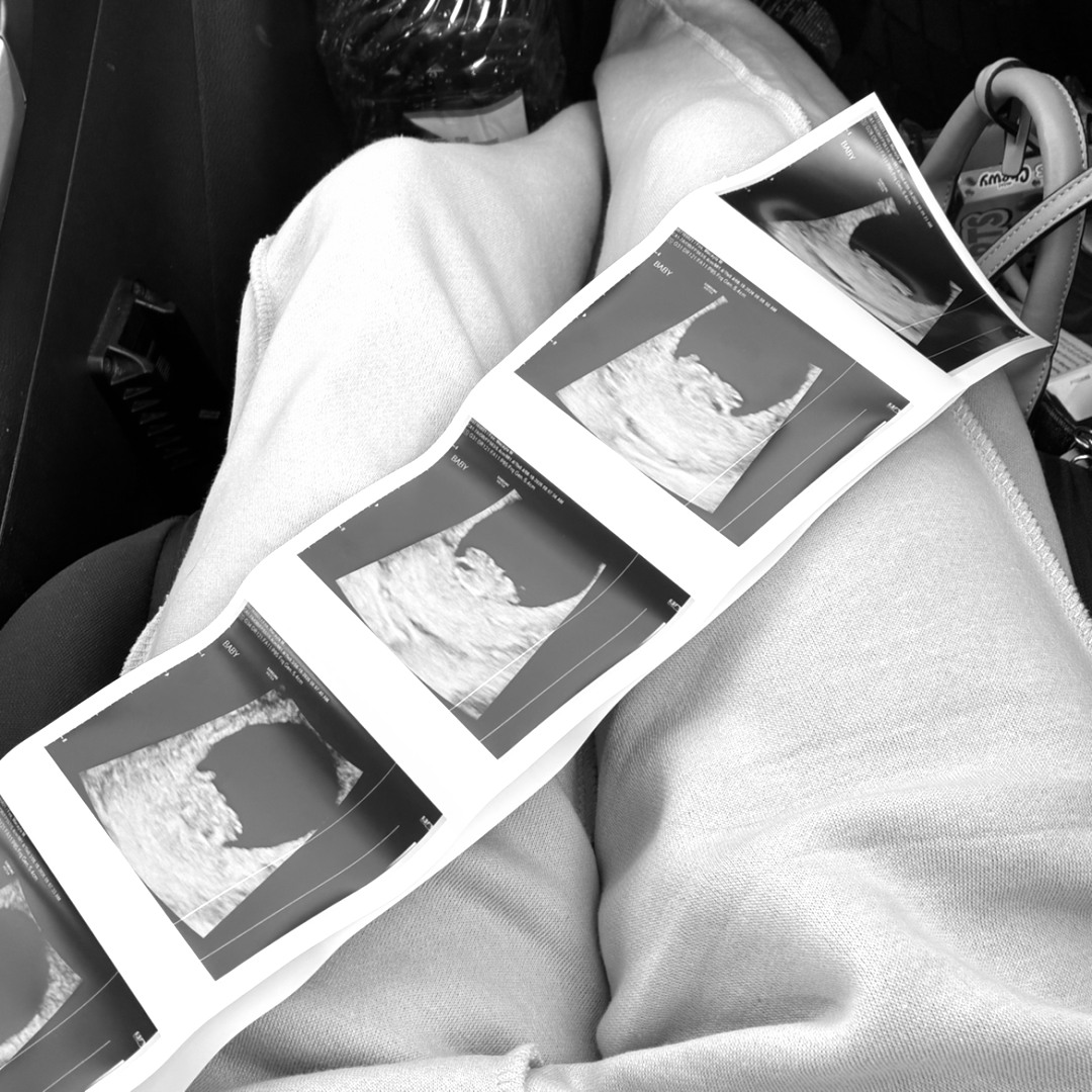 Photo shared by Macayla for their Babylist baby registry.