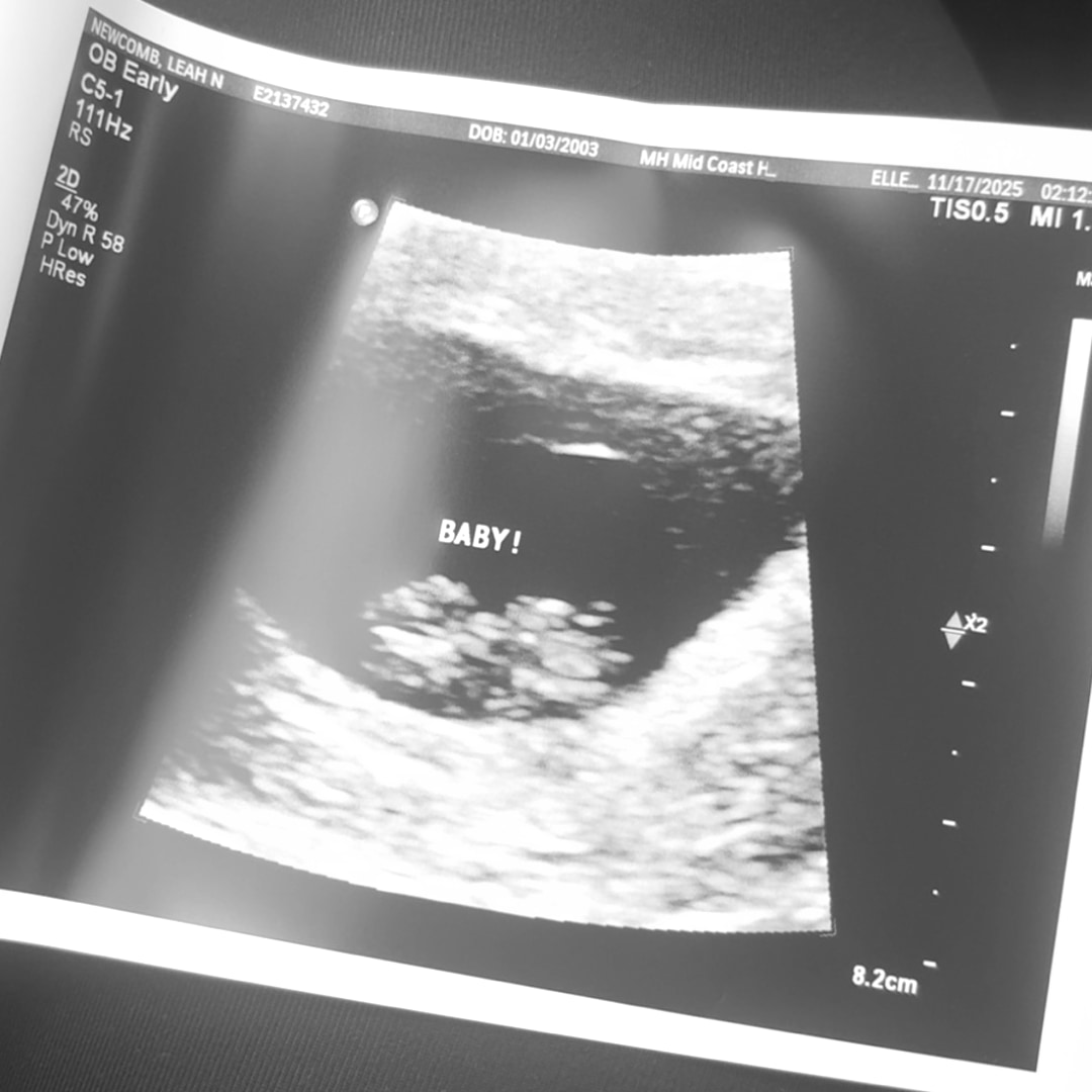 Photo shared by Leah for their Babylist baby registry.