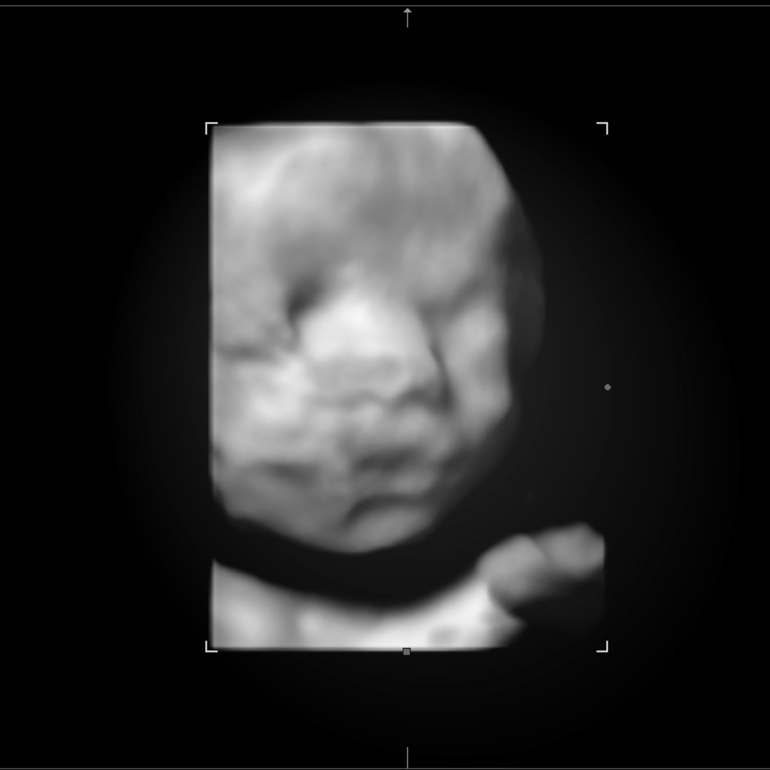 Photo shared by Georgia for their Babylist baby registry.