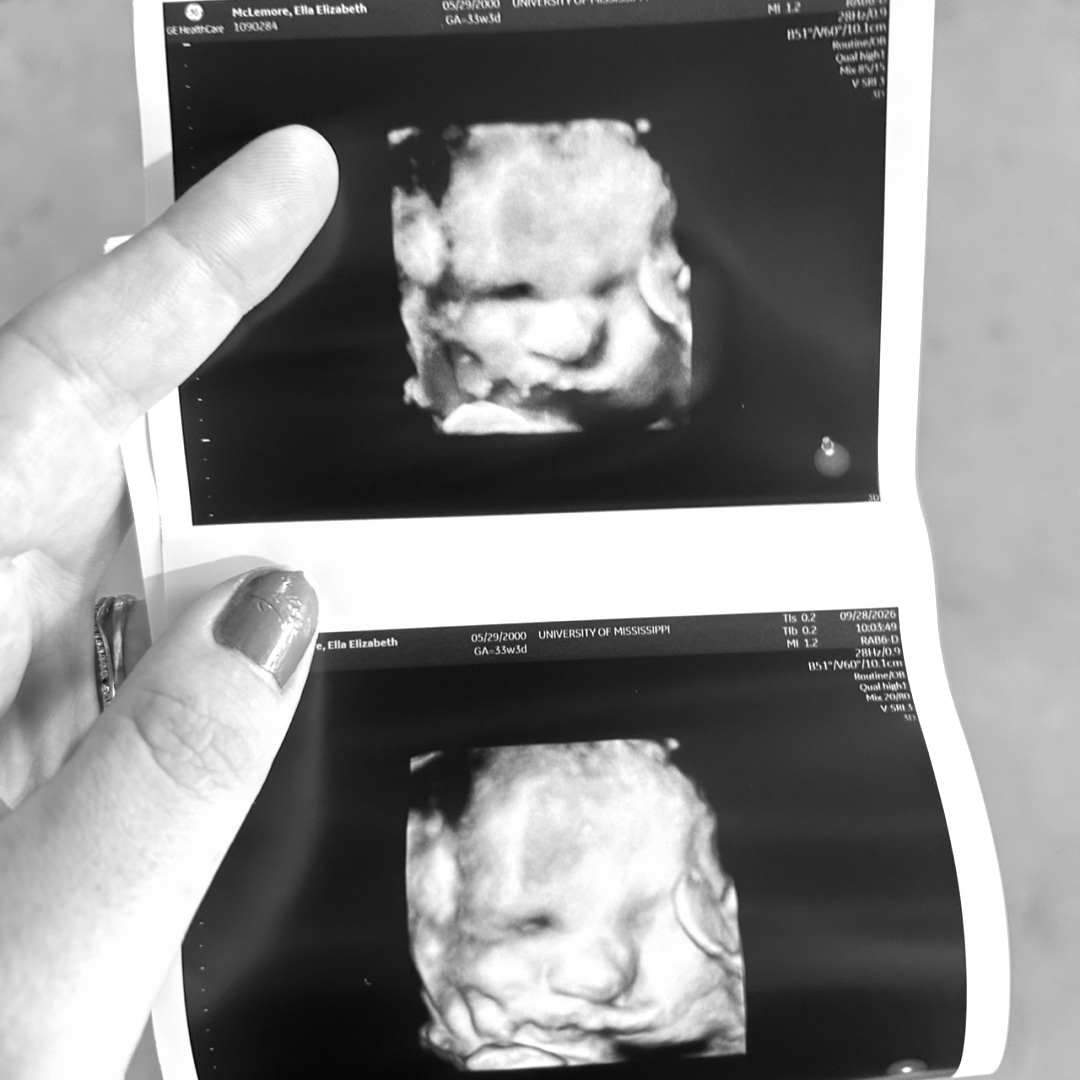 Photo shared by Ella for their Babylist baby registry.