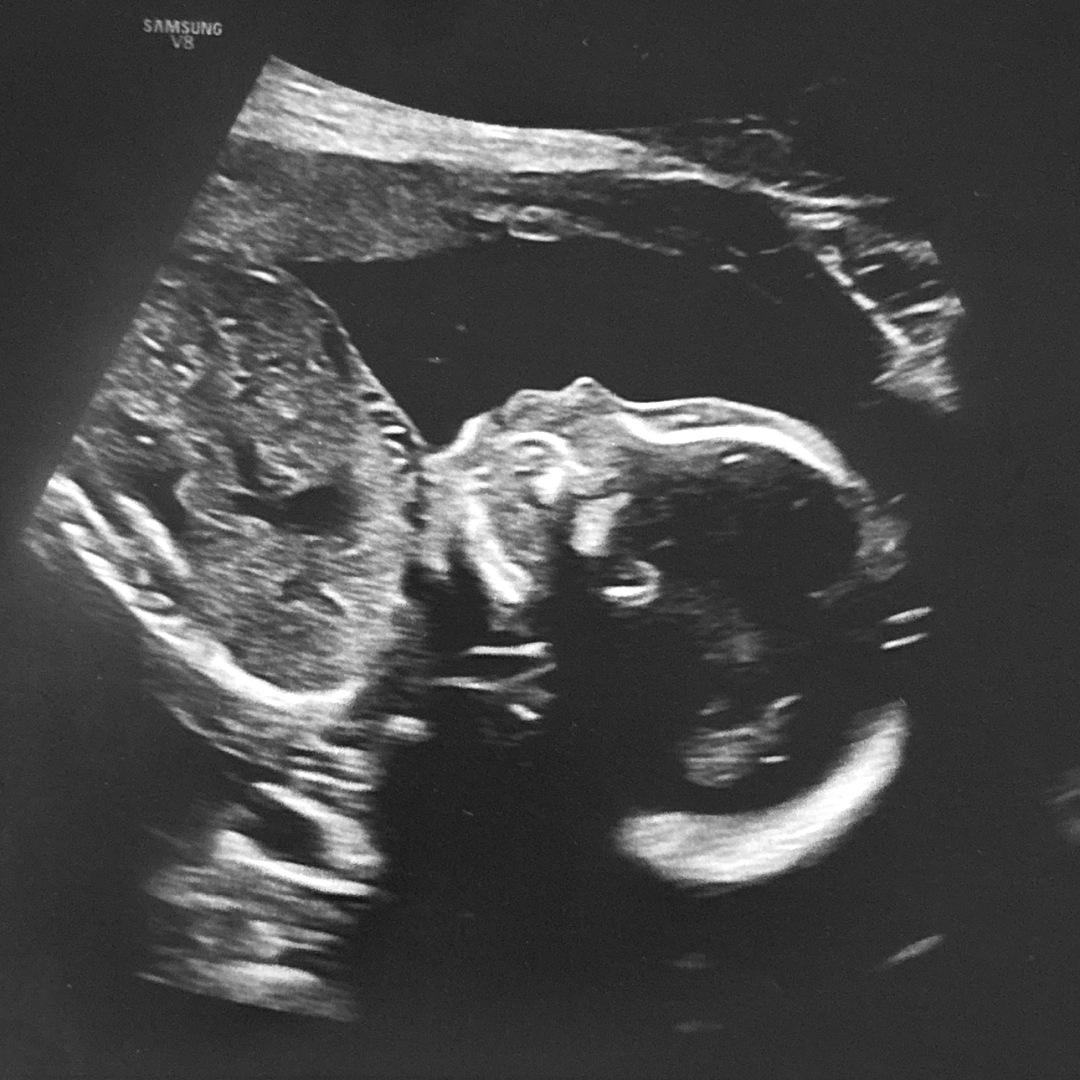 Photo shared by Kristin for their Babylist baby registry.