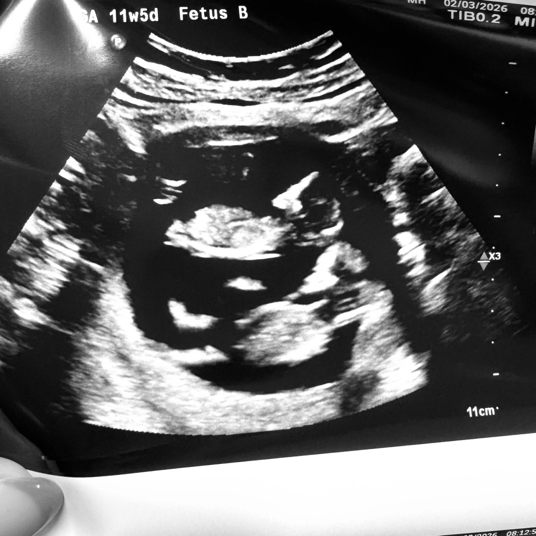 Photo shared by Betty for their Babylist baby registry.