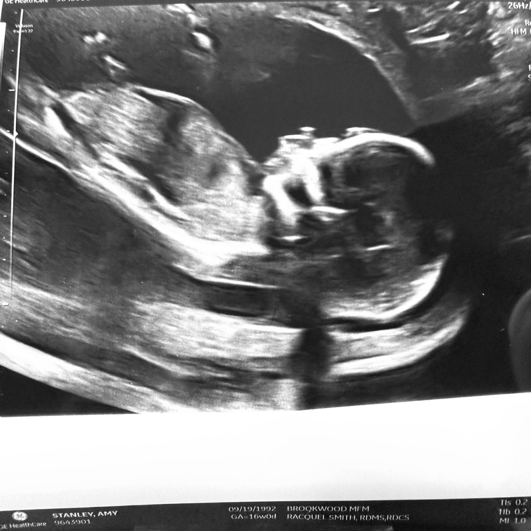 Photo shared by Brooklyn for their Babylist baby registry.