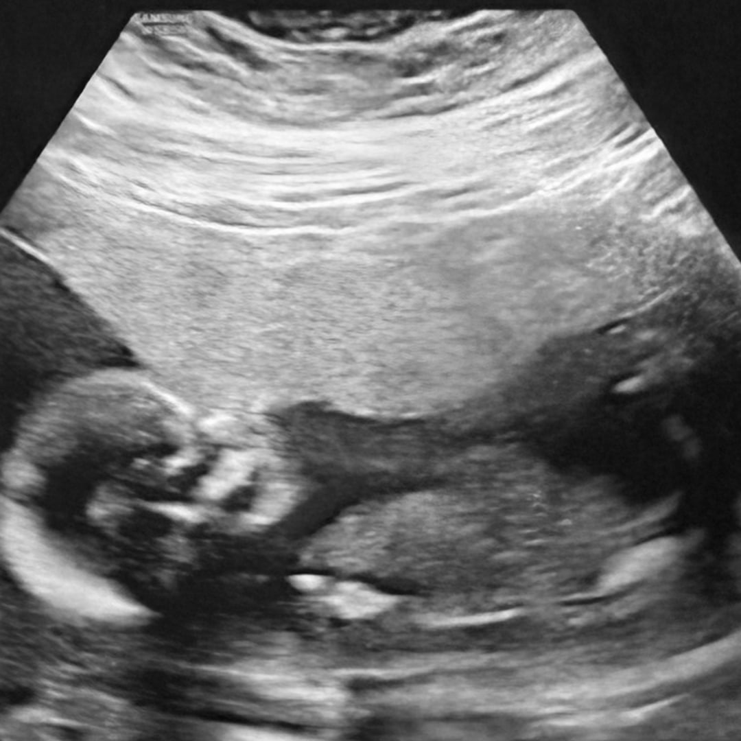 Photo shared by Jocelyn for their Babylist baby registry.