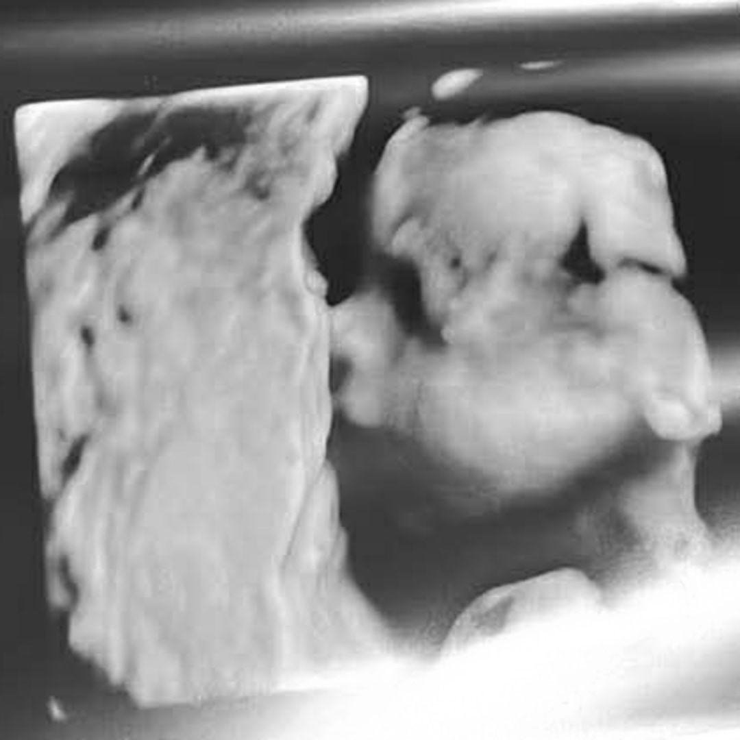 Photo shared by Destiny for their Babylist baby registry.
