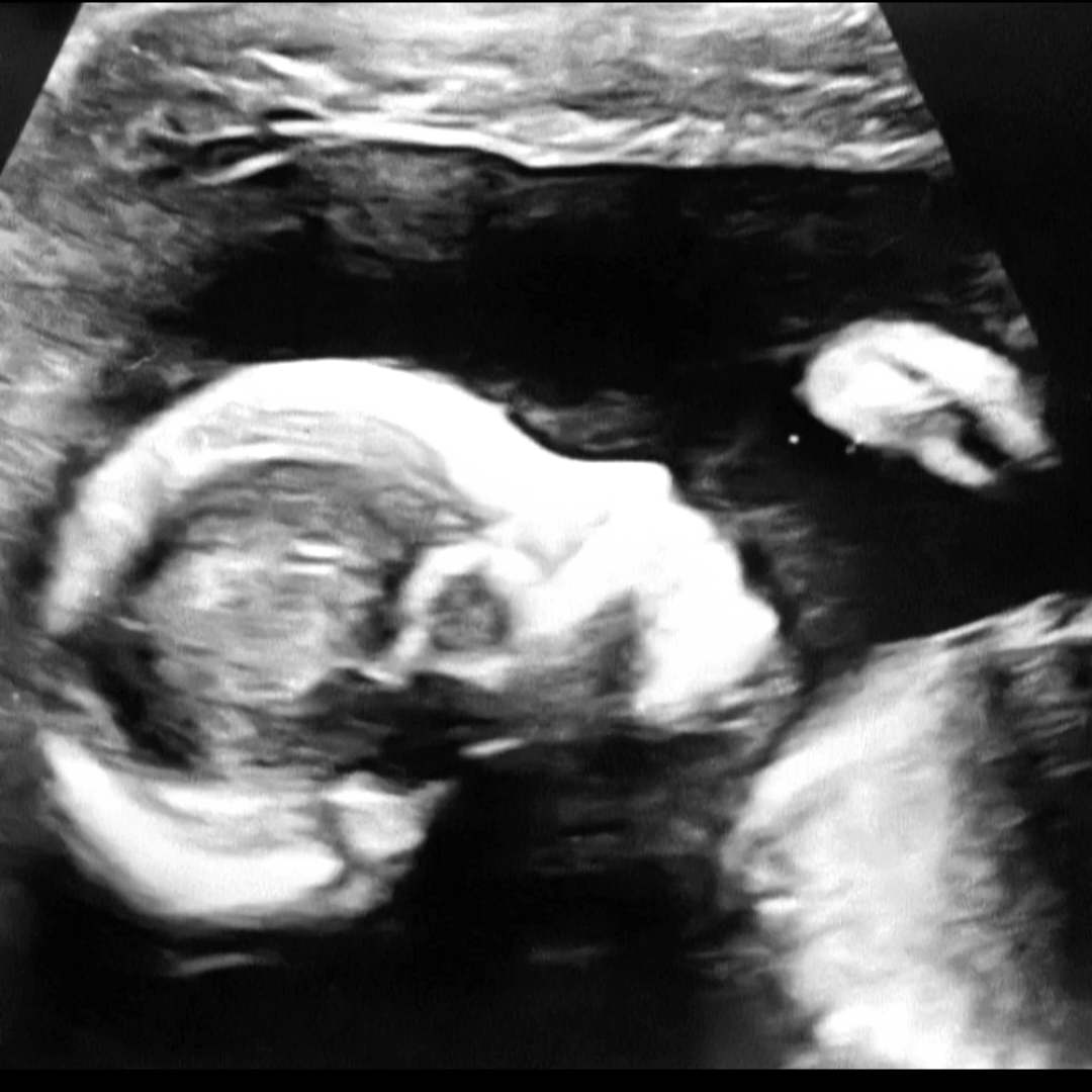 Photo shared by Esme for their Babylist baby registry.