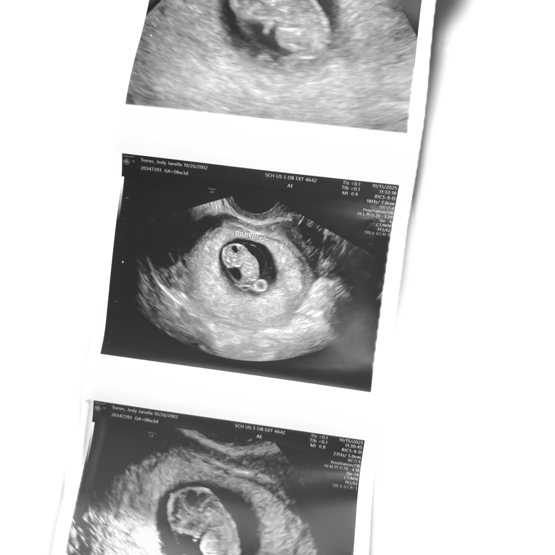 Photo shared by Janelle for their Babylist baby registry.