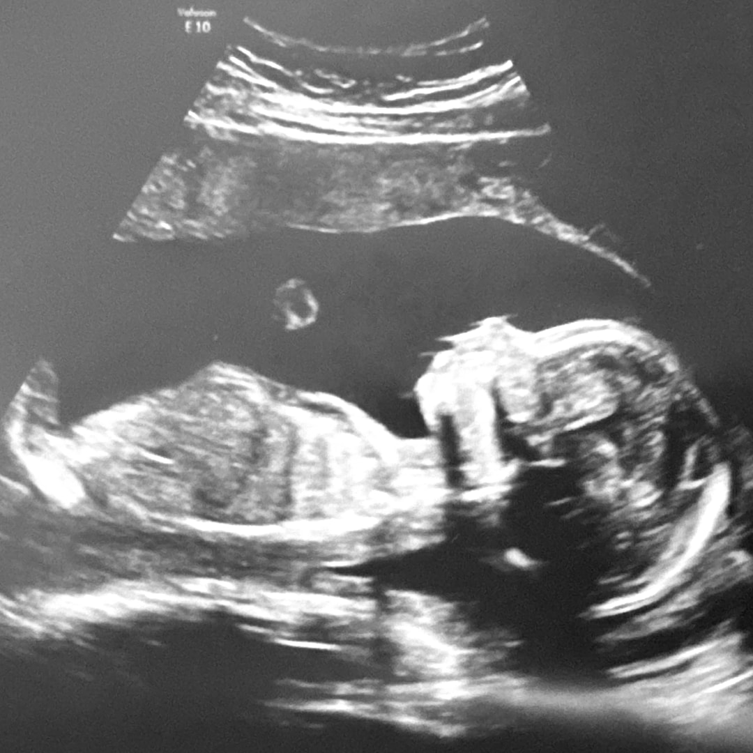 Photo shared by Alli for their Babylist baby registry.