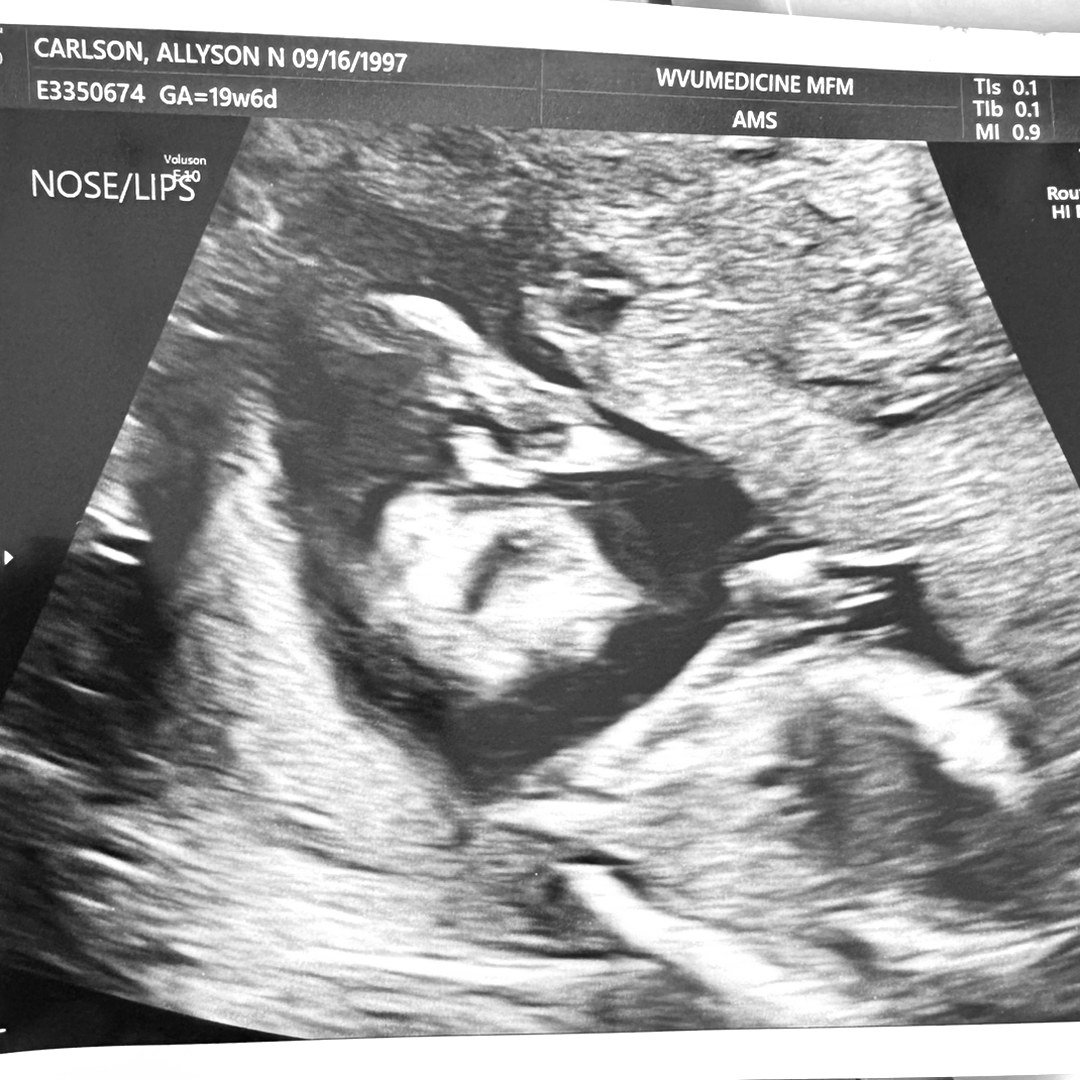 Photo shared by Allyson for their Babylist baby registry.