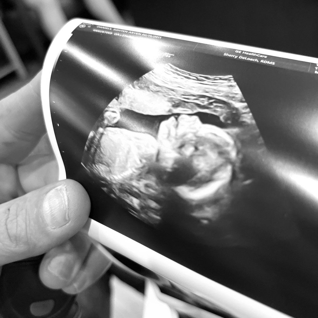 Photo shared by Ashten for their Babylist baby registry.