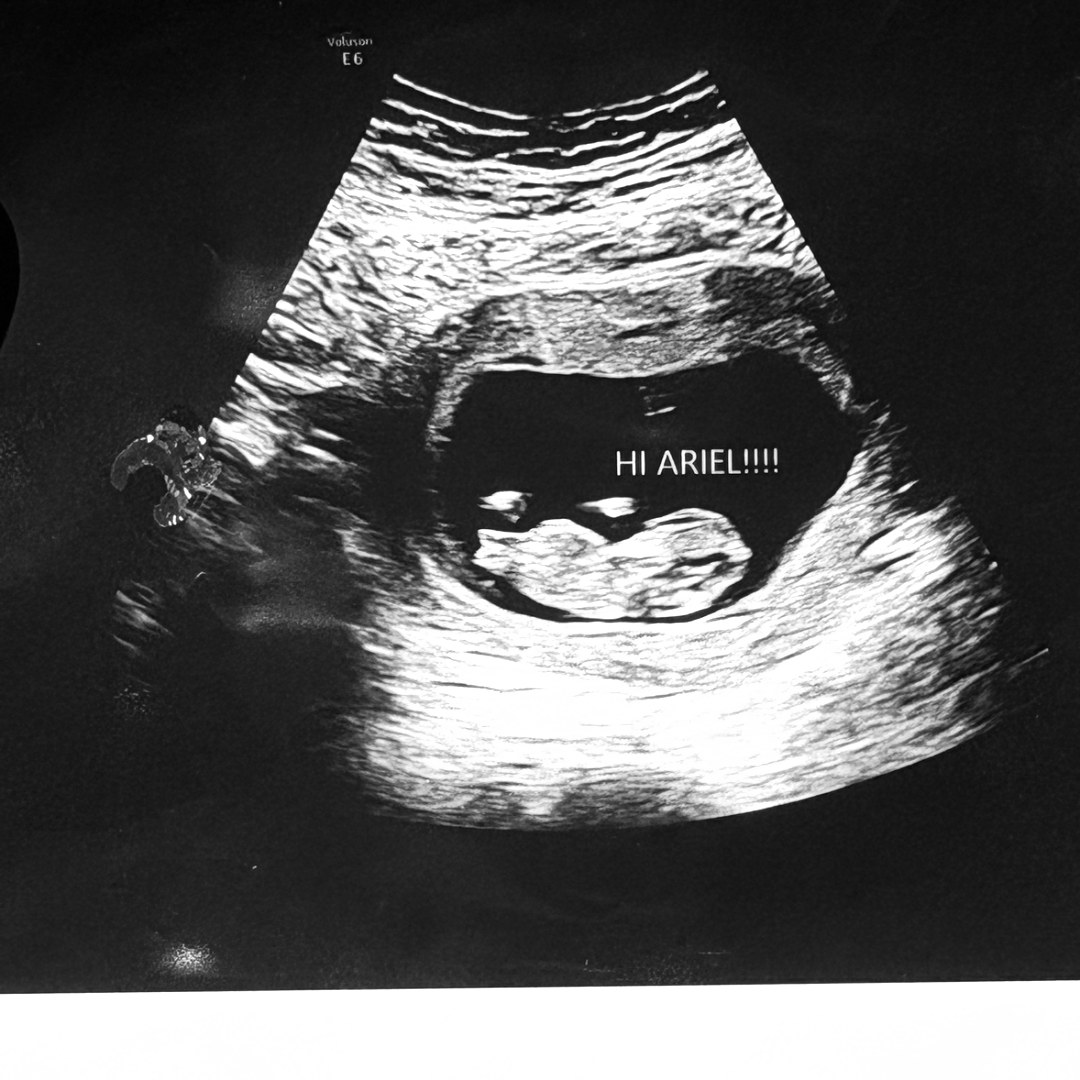 Photo shared by Casandra for their Babylist baby registry.