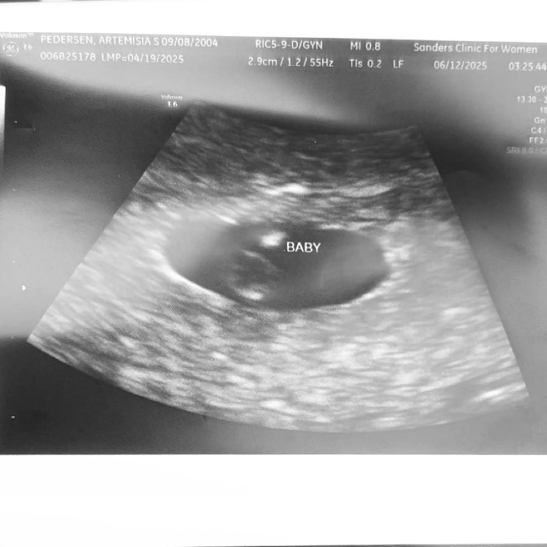 Photo shared by Artemisia for their Babylist baby registry.