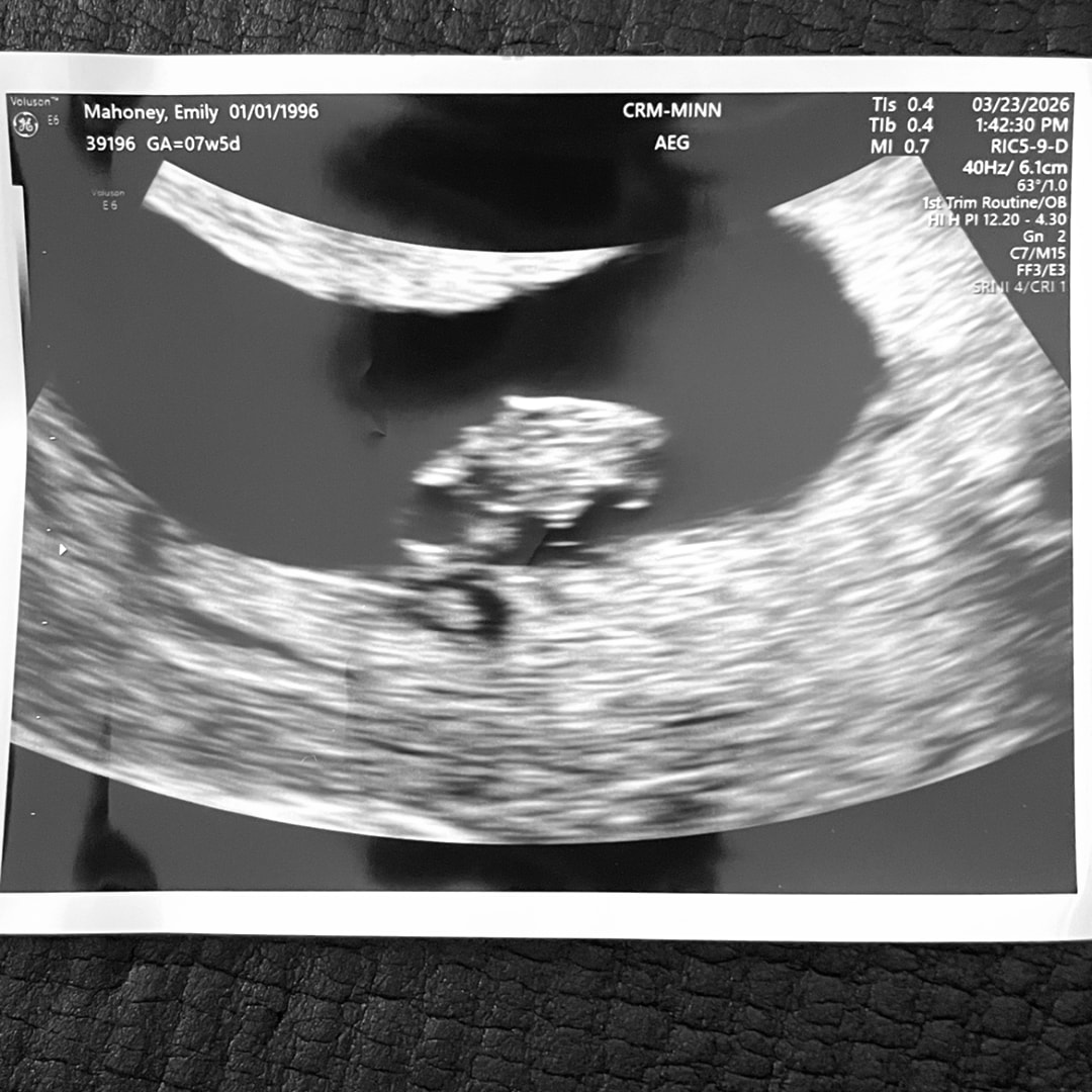 Photo shared by Emily for their Babylist baby registry.