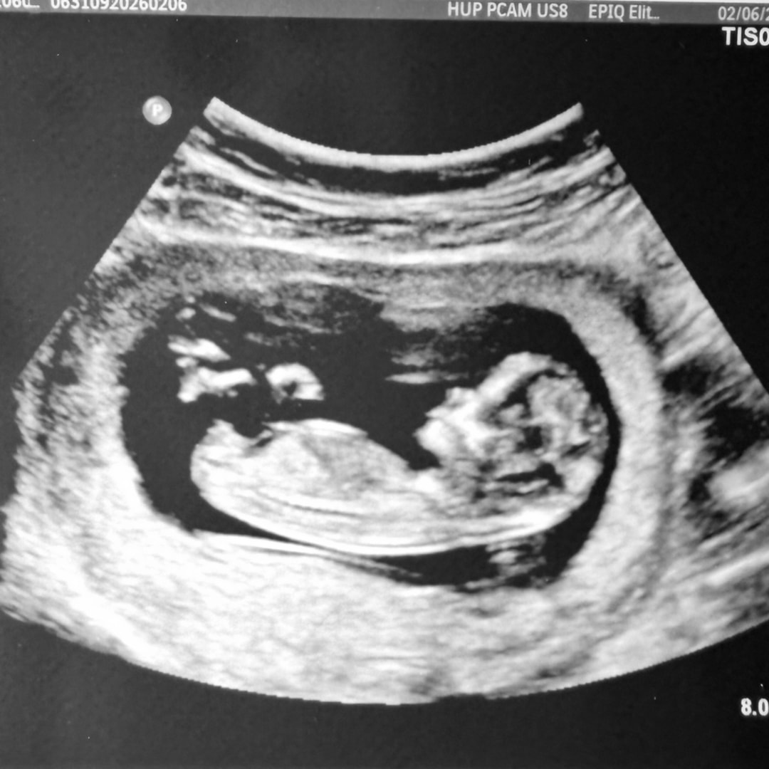 Photo shared by Kristen for their Babylist baby registry.