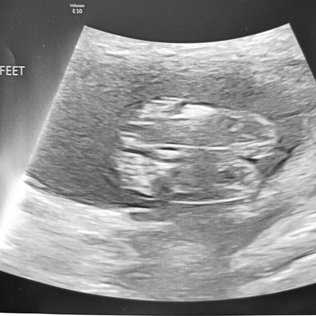 Photo shared by Terri for their Babylist baby registry.