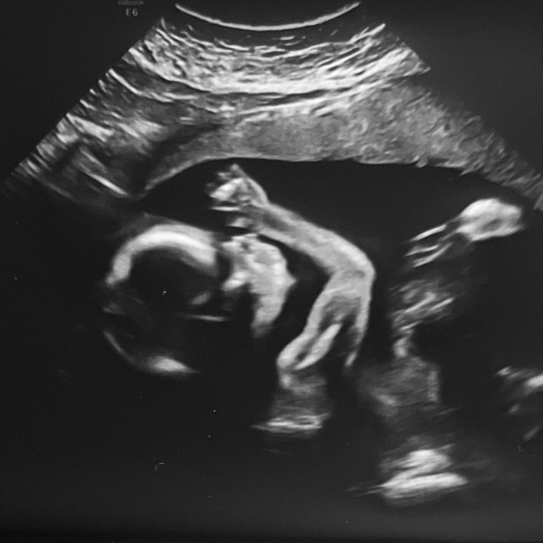 Photo shared by Gianna for their Babylist baby registry.