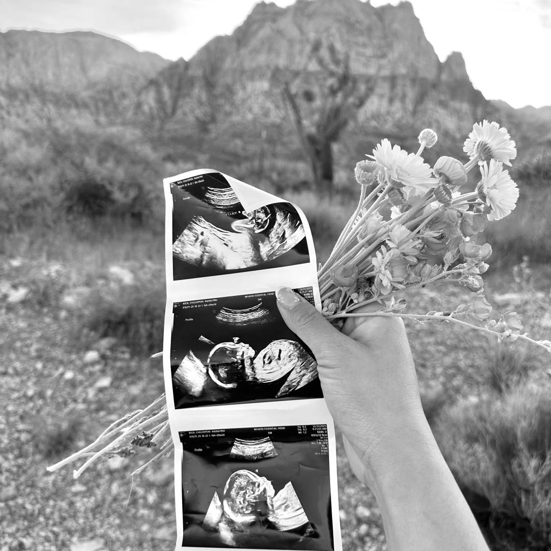 Photo shared by Chulee for their Babylist baby registry.