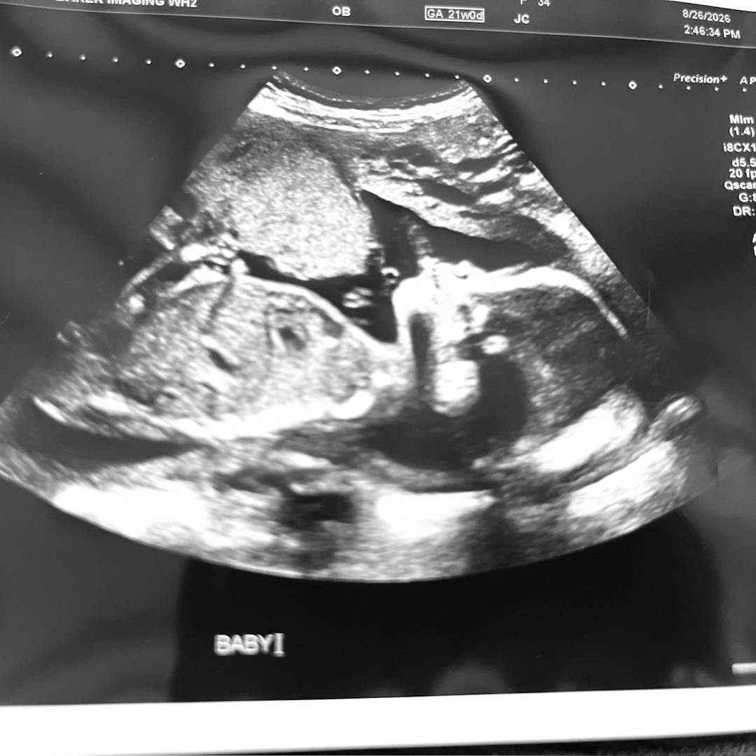 Photo shared by Em for their Babylist baby registry.