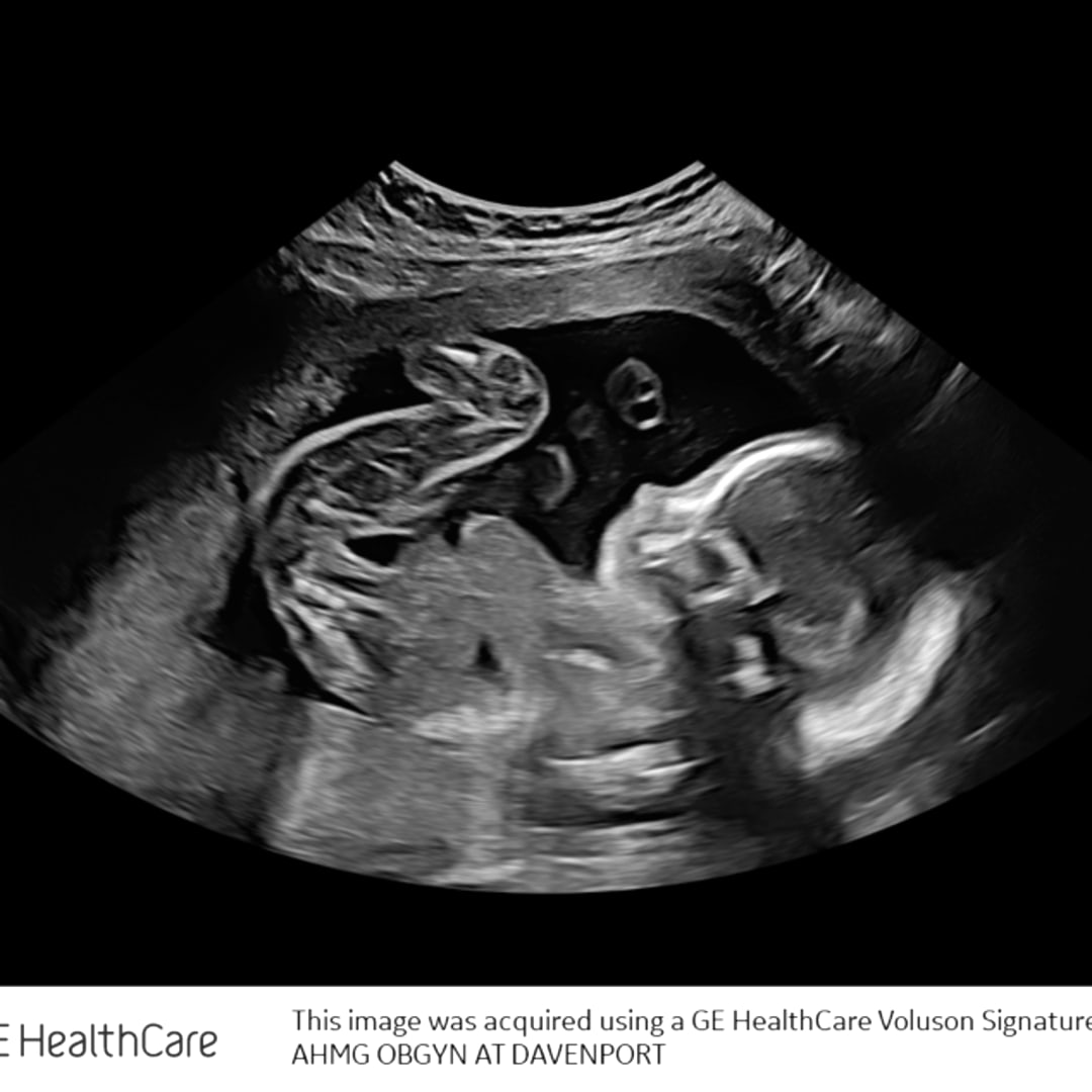 Photo shared by Jessica for their Babylist baby registry.