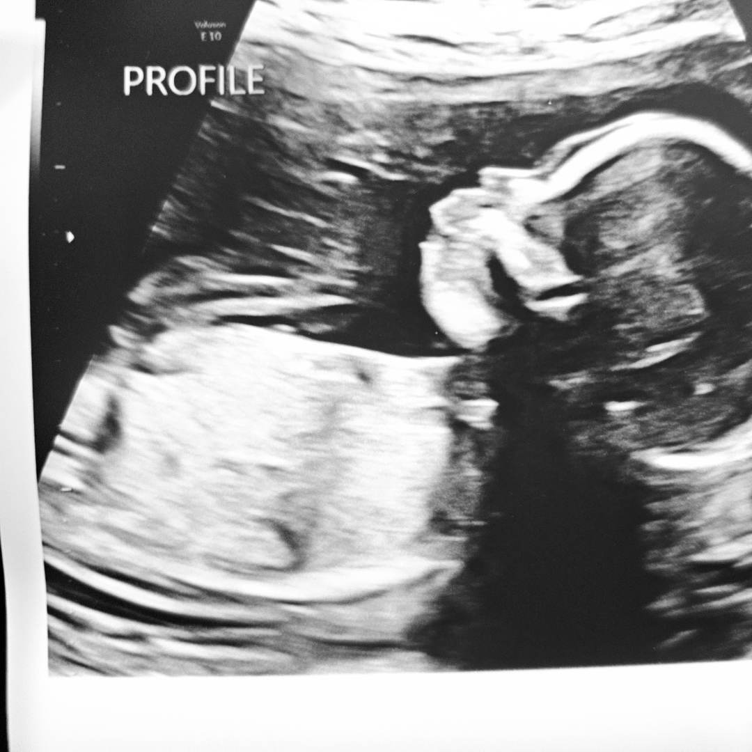 Photo shared by Cheza for their Babylist baby registry.